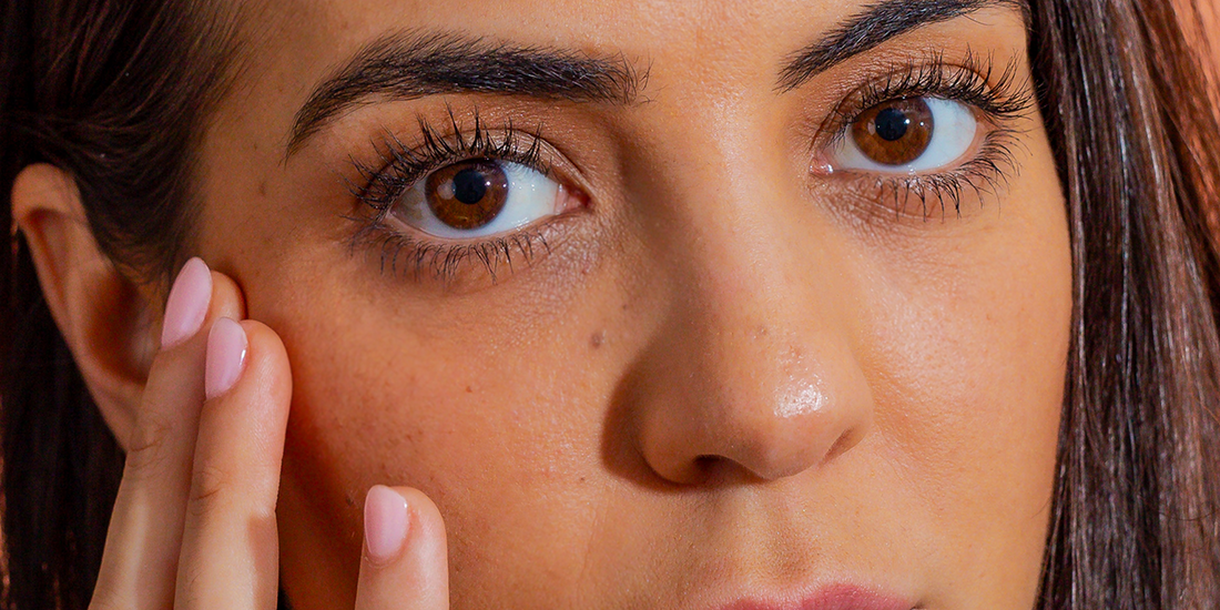 This natural ingredient can heal a sunburn. - Flora Mirabilis