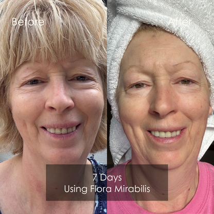 Results after 7 days of using Holy Grail Face Oil