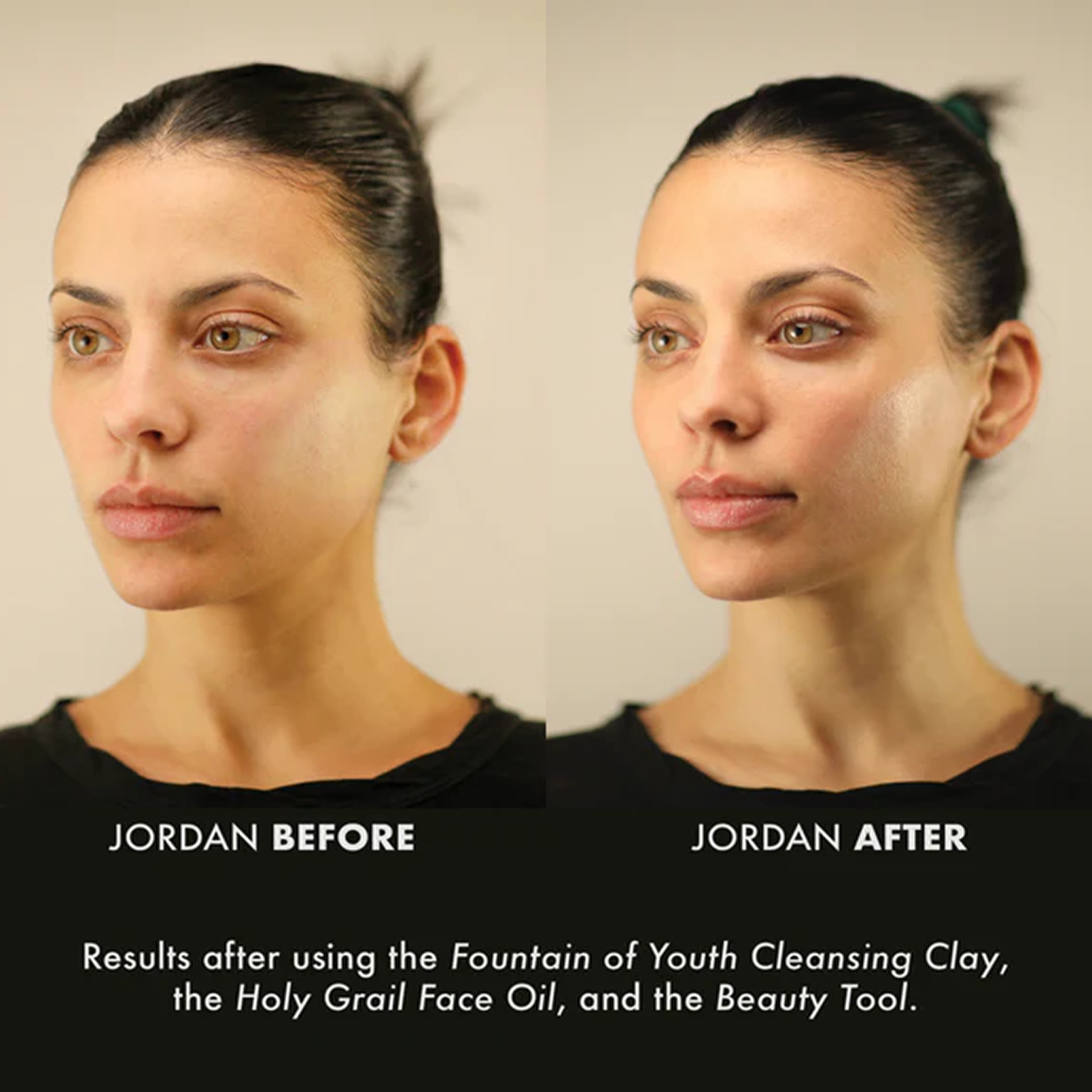 Jordan before and after using Fountain of Youth Cleansing Clay, Holy Grail Face Oil and the Beauty Tool.